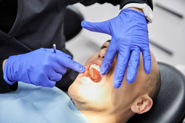 Best Emergency Tooth Extraction in Crosspointe, VA