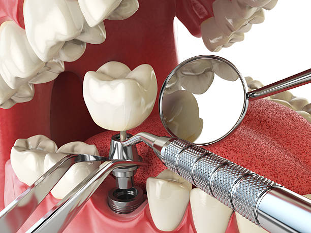 Best Emergency TMJ Treatment in Crosspointe, VA